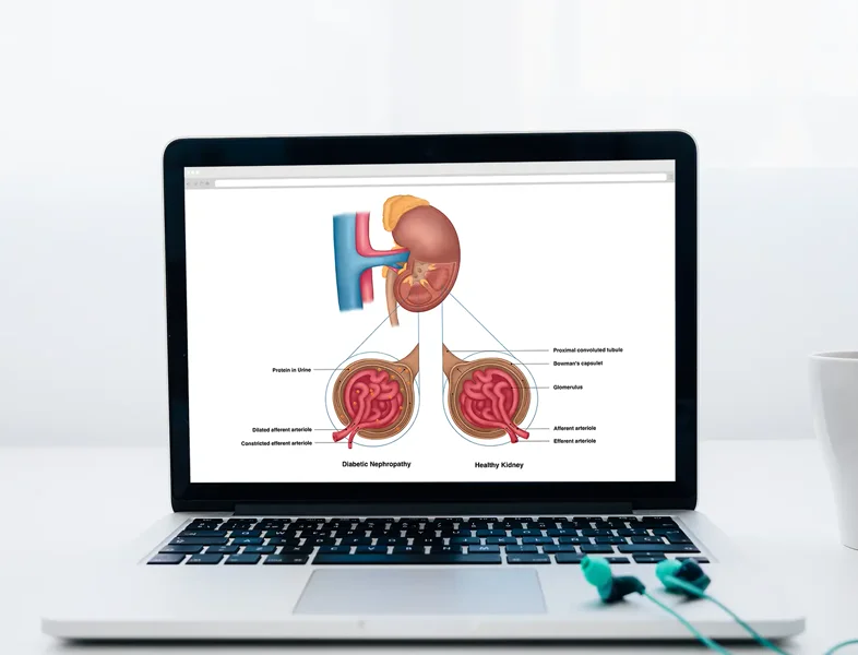 Diabetes Complications medical illustration series